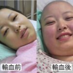 【芸能】女優・友寄蓮、治療中に輸血を受けた回数は100回以上「輸血前後の顔色はこれくらい違います」