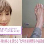 【芸能】秋野暢子、原因不明の足の痛みに悩み「ネットで調べると足底筋膜炎というのが出てくる…」