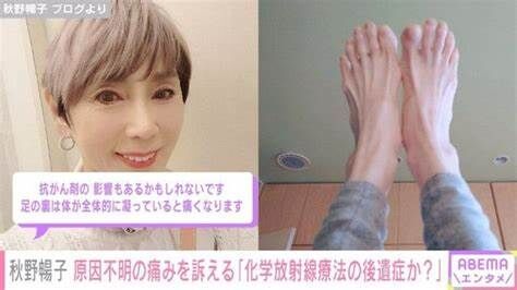 【芸能】秋野暢子、原因不明の足の痛みに悩み「ネットで調べると足底筋膜炎というのが出てくる…」