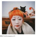 【芸能】日本エレキテル連合・中野聡子、手術を決断 テープ芸で顔に異変 「頭痛もひどい」
