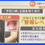 【必見】乳幼児を中心に手足口病患者急増、大阪府が5年ぶりの警報発令‼
